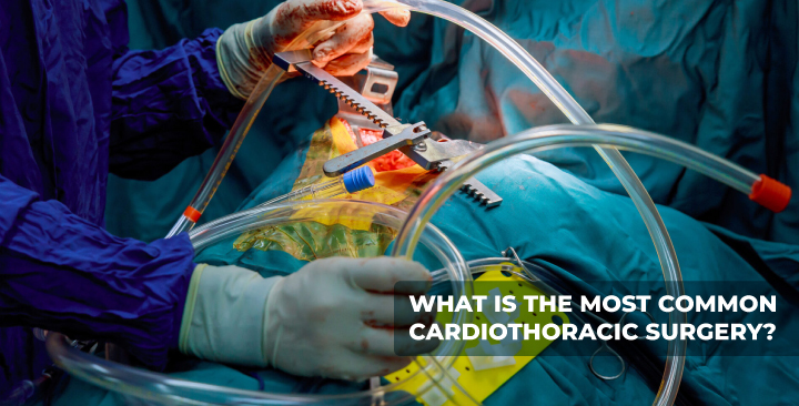 What is the Most Common Cardiothoracic Surgery