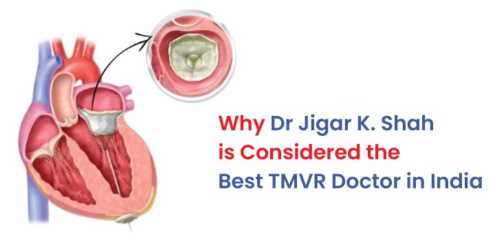 Why Dr Jigar K. Shah Is Considered the Best TMVR Doctor in India